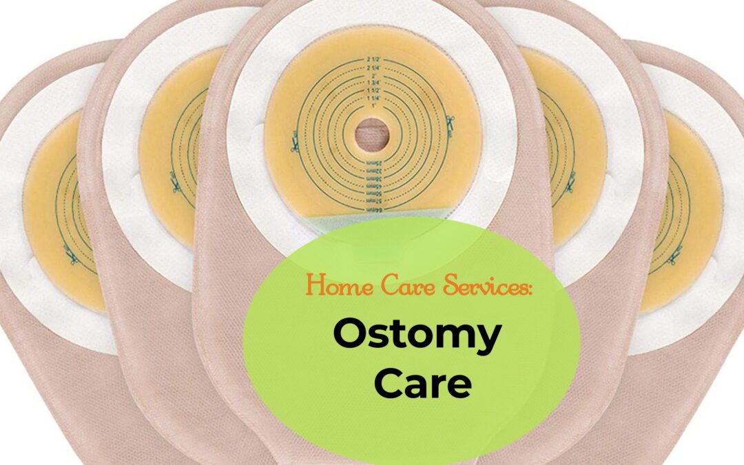 Home Care Service: Ostomy Care