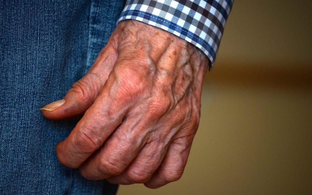 Understanding Arthritis in Seniors