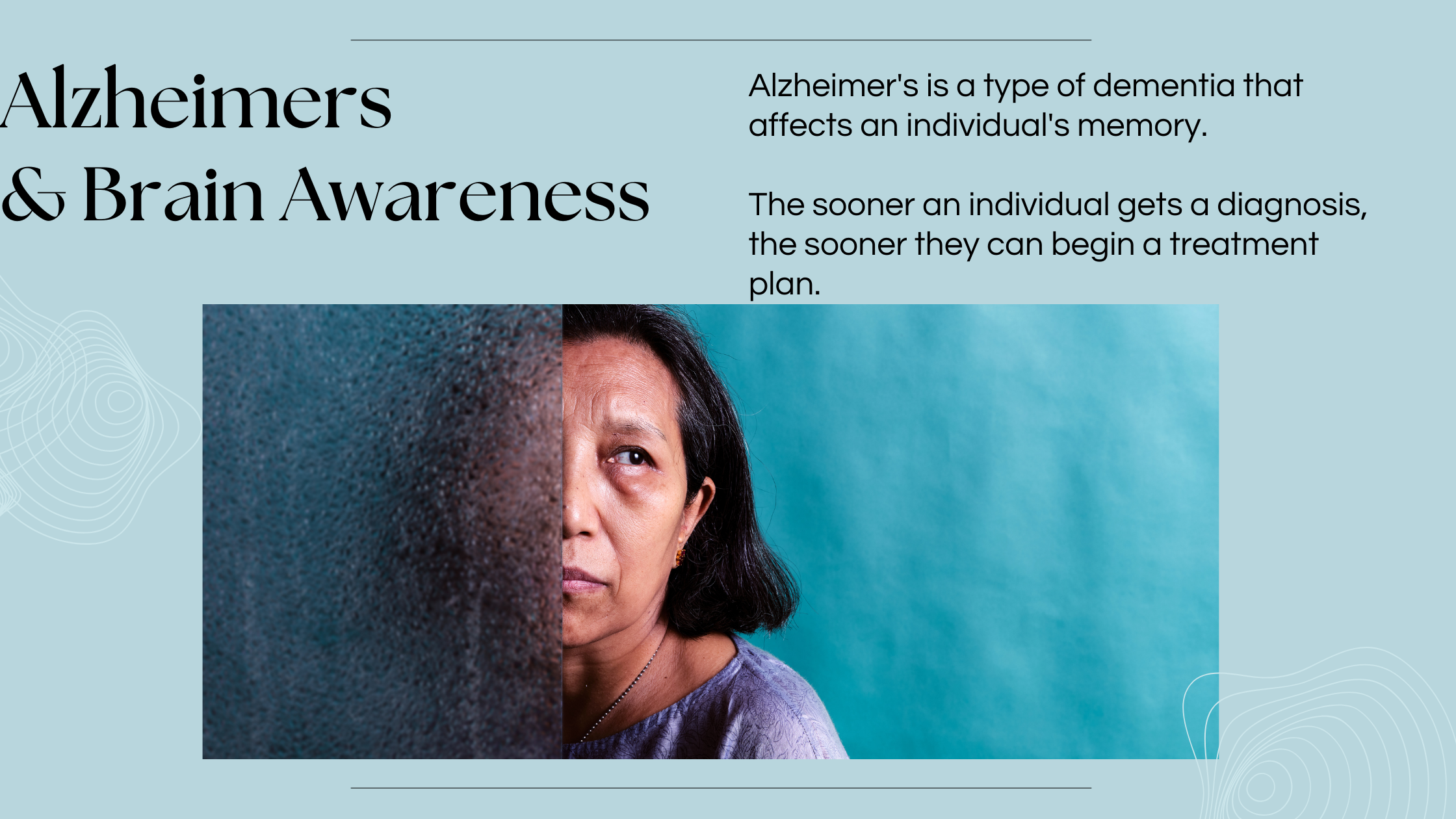 Alzheimer's & Brain Awareness